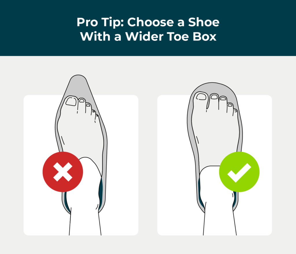 wider toe box for bunions