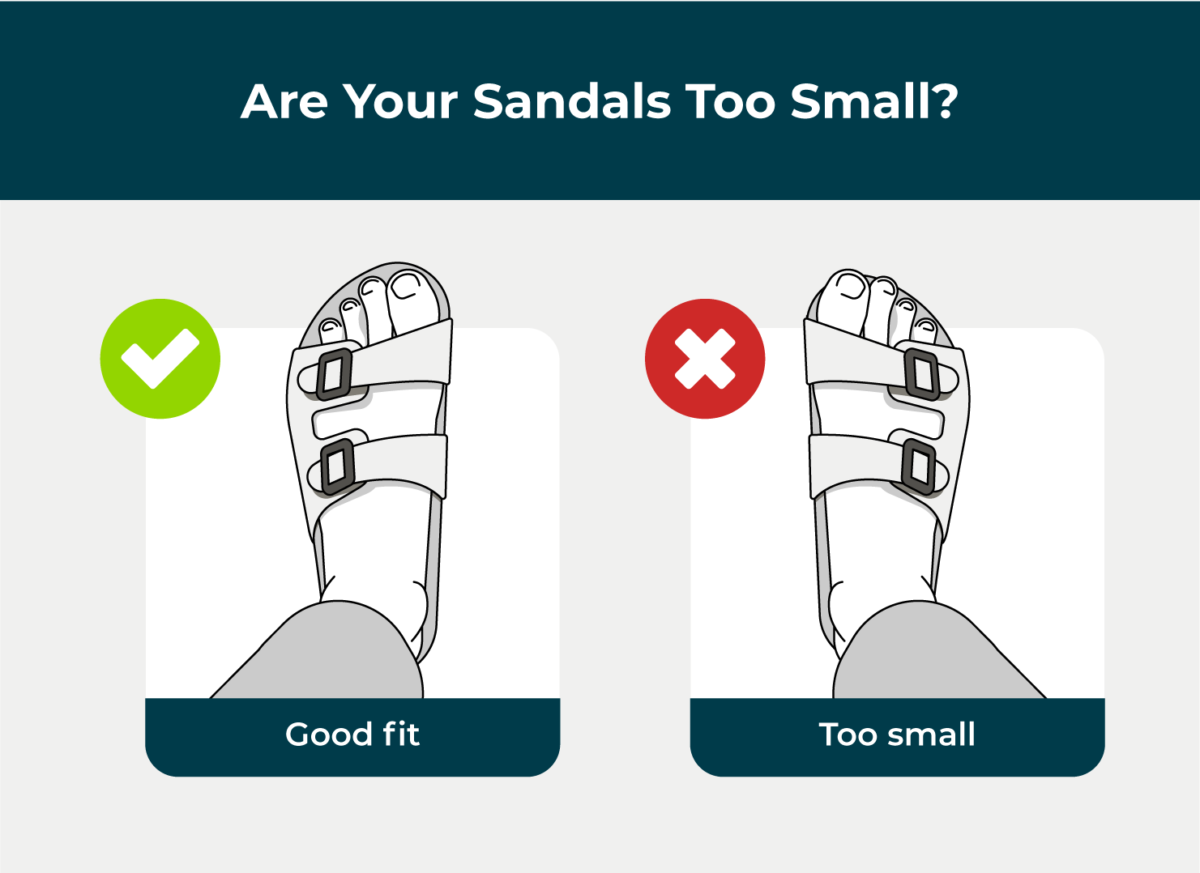 A visual showing that overhanging toes makes for a sandal that’s too small.