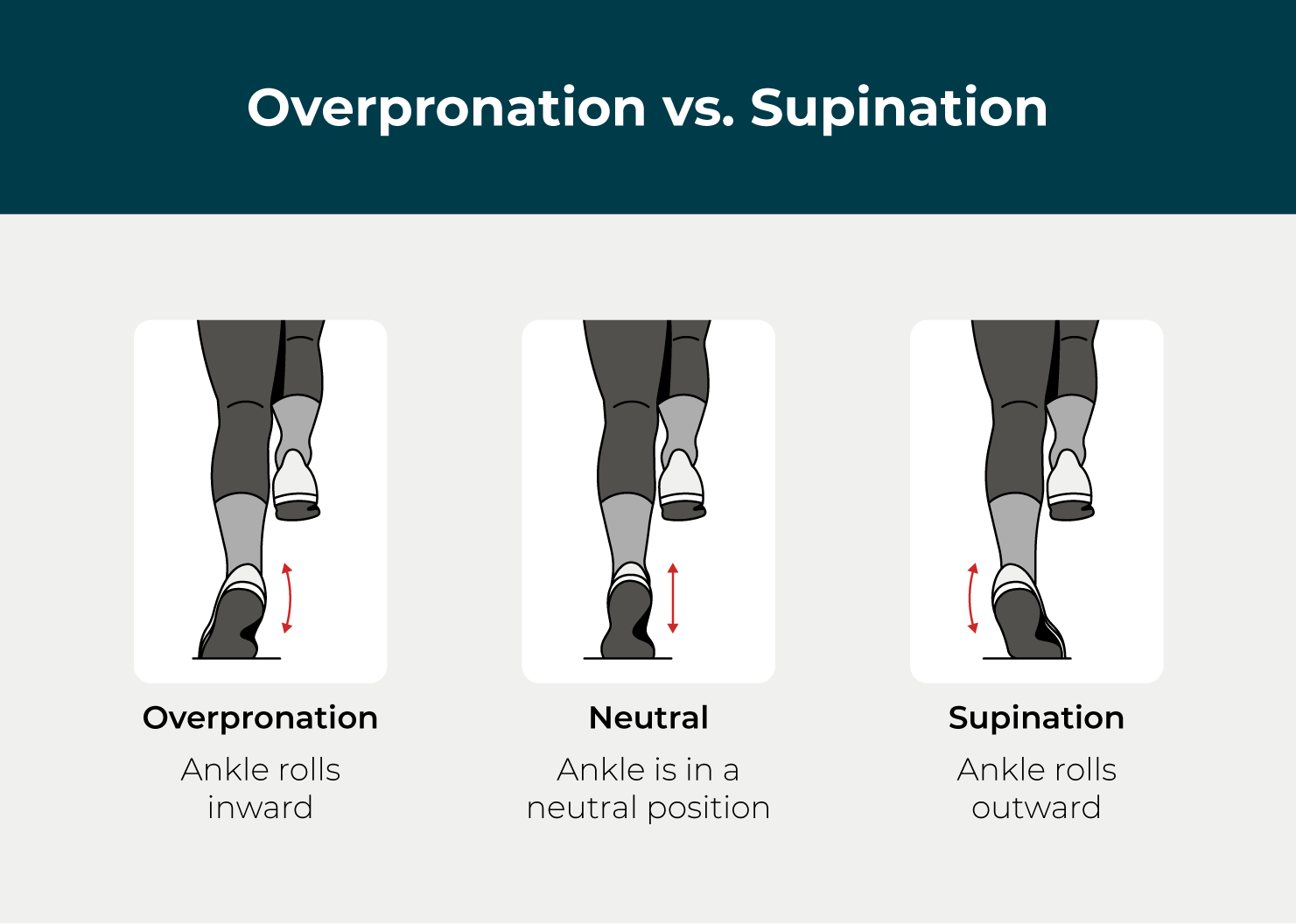 overpronation-vs-supination