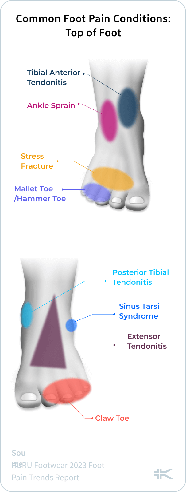 https://kuruexpertscorner.com/wp-content/uploads/2023/04/Common-Foot-Pain-Conditions_-Top-of-Foot-1-284x750.png