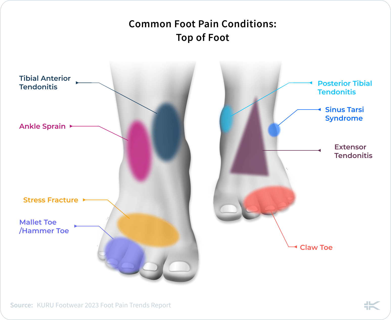 https://kuruexpertscorner.com/wp-content/uploads/2023/04/Common-Foot-Pain-Conditions_-Top-of-Foot-1200x984.png